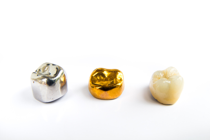 歯科用、金および金属の歯の冠